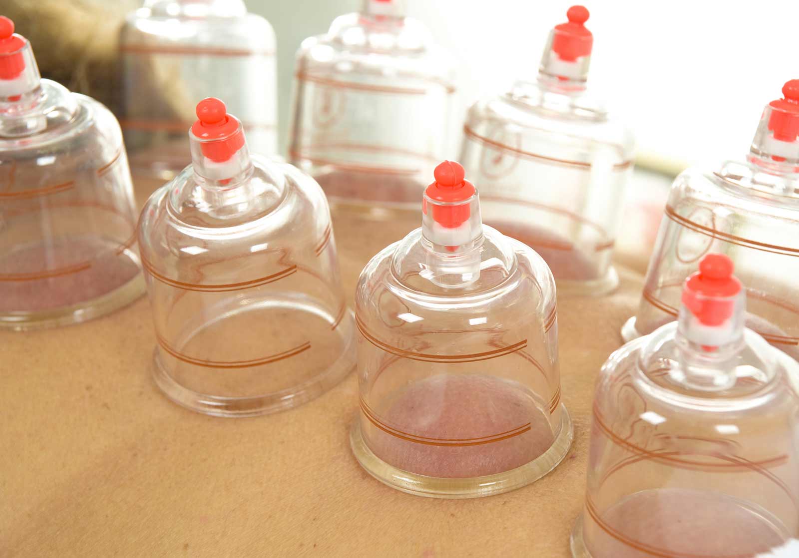 Pressotherapy, Cupping Therapy